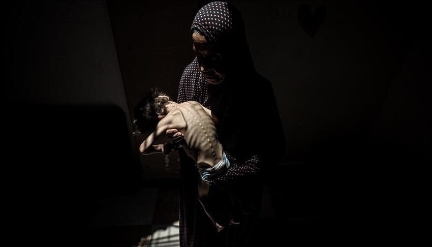  5 palestinezë të tjerë vdesin nga uria gjatë 24 orëve të fundit në Rripin e Gazës