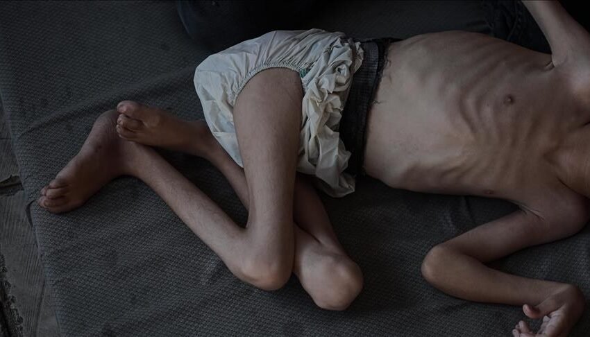  Në 24 orët fundit në Gaza vdesin nga uria 6 persona të tjerë, përfshirë një fëmijë