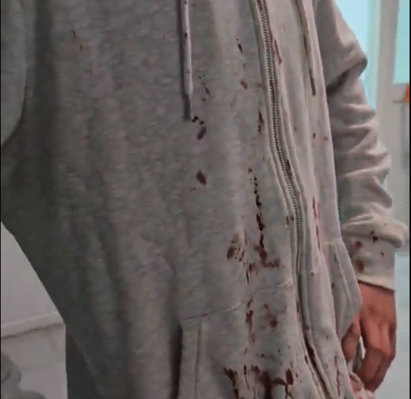  Policia arreston një “Vojvodë” dhe identifikon të tjerë që kanë rrahur dy të miturit shqiptar