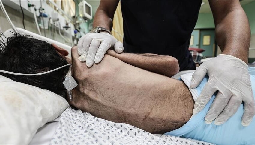  Në 24 orët fundit në Gaza vdesin nga uria 5 persona të tjerë